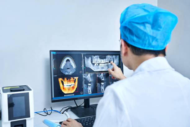 Best Emergency Wisdom Teeth Removal in Rawls Springs, MS