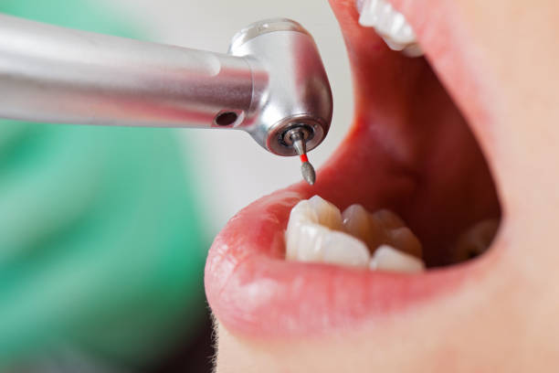 Best Urgent Care for Lost Fillings or Crowns in Rawls Springs, MS